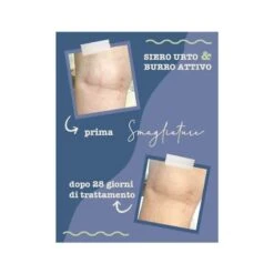 La Saponaria Siero Urto Smagliature 100ml -BioNike Online doccia shampoo barca mare camp 984520027 1 4 1668417434